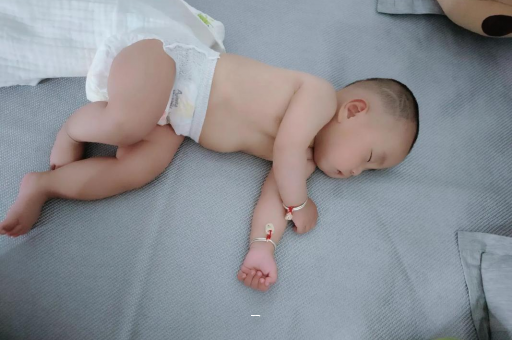 仁寿宝宝脸上有白色斑块